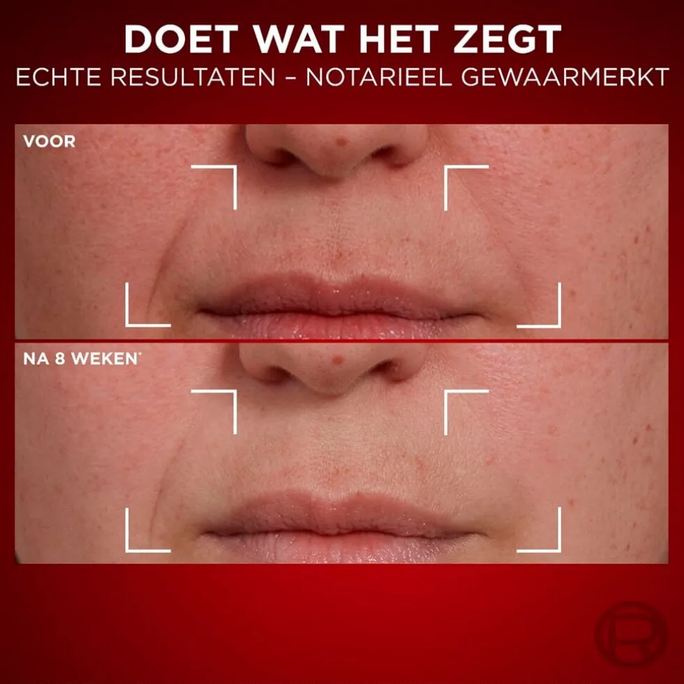 L'Oréal Paris Revitalift Laser Anti-Rimpel Dagcrème