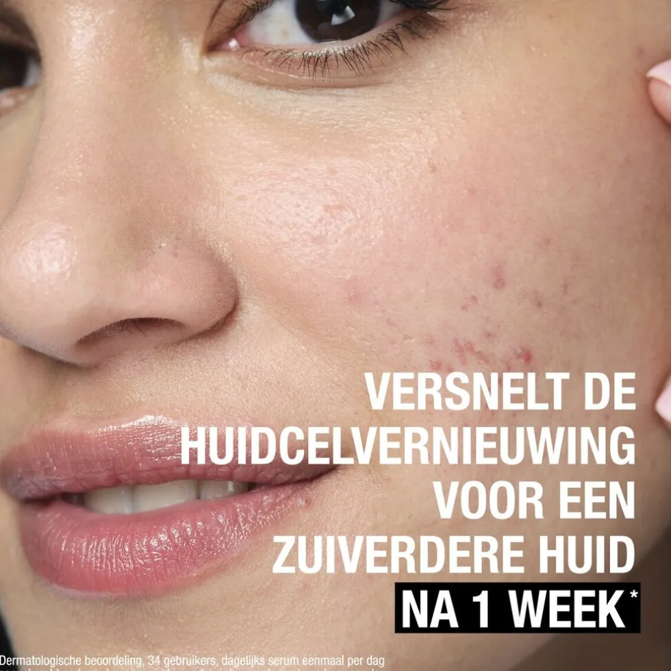 Neutrogena Anti-Puistjes+ Wasgel